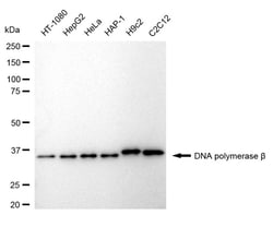 Invitrogen POLB Recombinant Rabbit Monoclonal Antibody (24GB1475) 100 &mu;L;