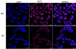 Invitrogen FGF2 Recombinant Rabbit Monoclonal Antibody (24GB4420) 100 &mu;L;