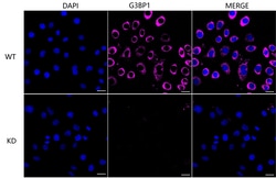 Invitrogen G3BP1 Recombinant Rabbit Monoclonal Antibody (24GB4580) 100