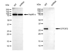 Invitrogen GTF2F2 Recombinant Rabbit Monoclonal Antibody (24GB6035) 20