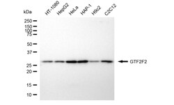 Invitrogen GTF2F2 Recombinant Rabbit Monoclonal Antibody (24GB6035) 20