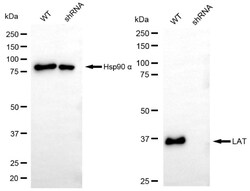 Invitrogen LAT Recombinant Rabbit Monoclonal Antibody (24GB4940):Antibodies:Primary
