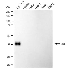 Invitrogen LAT Recombinant Rabbit Monoclonal Antibody (24GB4940) 20 &mu;L;