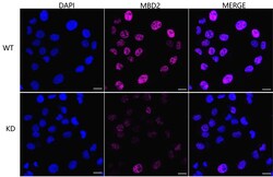 Invitrogen MBD2 Recombinant Rabbit Monoclonal Antibody (24GB4570) 20 &mu;L;