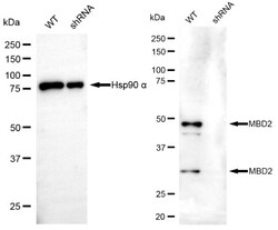 Invitrogen MBD2 Recombinant Rabbit Monoclonal Antibody (24GB4570) 20 &mu;L;