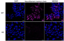 Invitrogen NEFM Monoclonal Antibody (24GB5825) 100 &mu;L; Unconjugated:Antibodies,