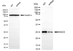 Invitrogen NQO2 Recombinant Rabbit Monoclonal Antibody (24GB250) 20 &mu;L;