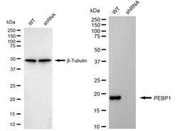 Invitrogen PEBP1 Recombinant Rabbit Monoclonal Antibody (24GB860) 20 &mu;L;