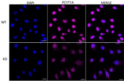 Invitrogen PCYT1A Recombinant Rabbit Monoclonal Antibody (24GB5015) 20