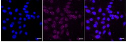 Invitrogen PDPK1 Recombinant Rabbit Monoclonal Antibody (24GB5425) 20 &mu;L;