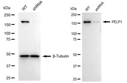 Invitrogen MNAR Recombinant Rabbit Monoclonal Antibody (24GB1145) 100 &mu;L;