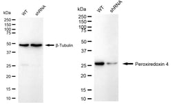 Invitrogen PRDX4 Recombinant Rabbit Monoclonal Antibody (24GB1570) 100