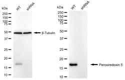 Invitrogen PRDX5 Recombinant Rabbit Monoclonal Antibody (24GB1025) 20 &mu;L;