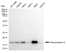 Invitrogen PRDX5 Recombinant Rabbit Monoclonal Antibody (24GB1025) 20 &mu;L;