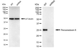 Invitrogen PRDX6 Recombinant Rabbit Monoclonal Antibody (24GB910) 20 &mu;L;