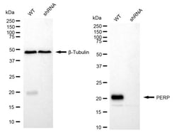Invitrogen PERP Recombinant Rabbit Monoclonal Antibody (24GB1630):Antibodies:Primary