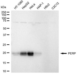 Invitrogen PERP Recombinant Rabbit Monoclonal Antibody (24GB1630) 100 &mu;L;