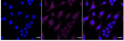 Invitrogen VPS34 Recombinant Rabbit Monoclonal Antibody (24GB1150):Antibodies:Primary