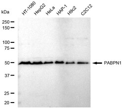 Invitrogen PABPN1 Recombinant Rabbit Monoclonal Antibody (24GB365) 100