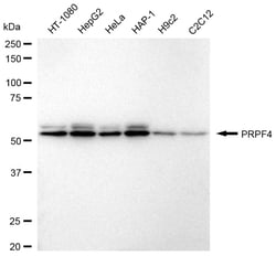 Invitrogen PRPF4 Recombinant Rabbit Monoclonal Antibody (24GB975) 20 &mu;L;