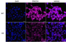 Invitrogen PRKCSH Recombinant Rabbit Monoclonal Antibody (24GB1325) 20