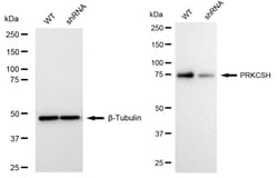 Invitrogen PRKCSH Recombinant Rabbit Monoclonal Antibody (24GB1325) 20