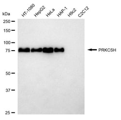 Invitrogen PRKCSH Recombinant Rabbit Monoclonal Antibody (24GB1325) 20