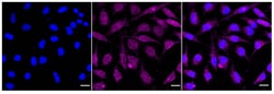 Invitrogen PRMT5 Recombinant Rabbit Monoclonal Antibody (24GB845):Anticuerpos:Anticuerpos