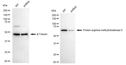Invitrogen PRMT5 Recombinant Rabbit Monoclonal Antibody (24GB845):Anticuerpos:Anticuerpos