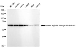 Invitrogen PRMT5 Recombinant Rabbit Monoclonal Antibody (24GB845) 100 &mu;L;