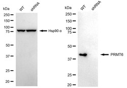 Invitrogen PRMT6 Recombinant Rabbit Monoclonal Antibody (24GB1585) 100