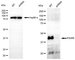 Invitrogen PAR4 Recombinant Rabbit Monoclonal Antibody (24GB5010) 20 &mu;L;