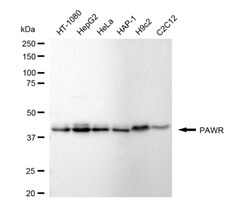Invitrogen PAR4 Recombinant Rabbit Monoclonal Antibody (24GB5010):Antibodies:Primary