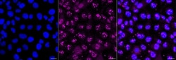 Invitrogen PSME1 Recombinant Rabbit Monoclonal Antibody (24GB1505) 20 &mu;L;