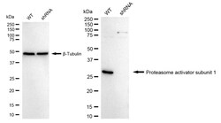 Invitrogen PSME1 Recombinant Rabbit Monoclonal Antibody (24GB1505) 20 &mu;L;
