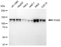 Invitrogen PUM2 Recombinant Rabbit Monoclonal Antibody (24GB1250):Antibodies:Primary