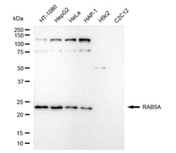 Invitrogen RAB5 Recombinant Rabbit Monoclonal Antibody (24GB4525) 100 &mu;L;