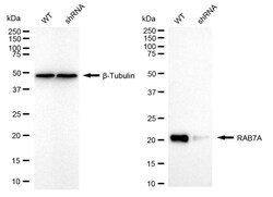 Invitrogen RAB7 Recombinant Rabbit Monoclonal Antibody (24GB895):Antibodies:Primary