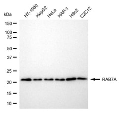 Invitrogen RAB7 Recombinant Rabbit Monoclonal Antibody (24GB895) 20 &mu;L;