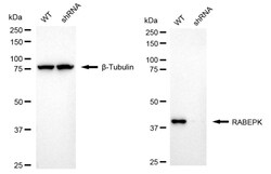 Invitrogen p40 Recombinant Rabbit Monoclonal Antibody (24GB1540) 100 &mu;L;