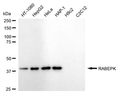 Invitrogen p40 Recombinant Rabbit Monoclonal Antibody (24GB1540) 100 &mu;L;