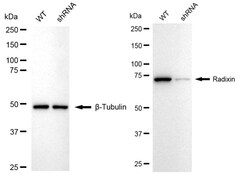 Invitrogen Radixin Recombinant Rabbit Monoclonal Antibody (24GB1420) 20