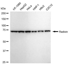 Invitrogen Radixin Recombinant Rabbit Monoclonal Antibody (24GB1420) 20