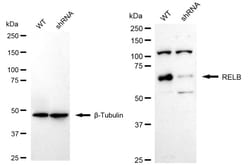 Invitrogen RelB Recombinant Rabbit Monoclonal Antibody (24GB925) 100 &mu;L;