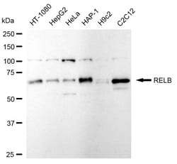 Invitrogen RelB Recombinant Rabbit Monoclonal Antibody (24GB925):Antibodies:Primary