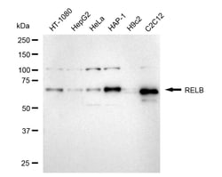 Invitrogen RelB Recombinant Rabbit Monoclonal Antibody (24GB5070) 20 &mu;L;