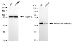 Invitrogen RARB Recombinant Rabbit Monoclonal Antibody (24GB1045) 100 &mu;L;