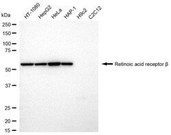 Invitrogen RARB Recombinant Rabbit Monoclonal Antibody (24GB1045) 100 &mu;L;