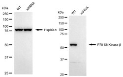 Invitrogen RPS6KB2 Recombinant Rabbit Monoclonal Antibody (24GB1235):Antibodies:Primary