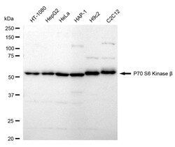 Invitrogen RPS6KB2 Recombinant Rabbit Monoclonal Antibody (24GB1235):Antibodies:Primary